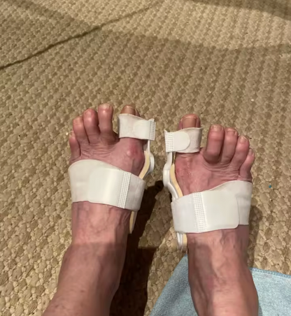 Thumb Valgus Toe Male And Female Corrector